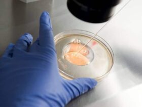 tratamiento-de-fertilizacion-in-vitro-mas-alla-de-la-infertilidad-fiv-procedimiento-fertilizacion-en-laboratorio-fiv-en-ingenes